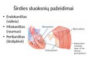 Širdies ir kraujagyslių sistemos ligos Lietuvoje 15 puslapis