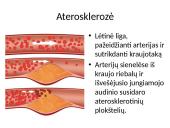 Širdies ir kraujagyslių sistemos ligos Lietuvoje 6 puslapis