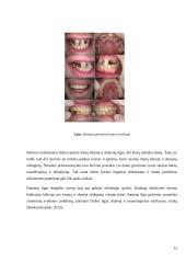 Burnos sveikatą lemiantys veiksmai 12 puslapis