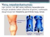 Kraujotakos sutrikimų konspektas 7 puslapis