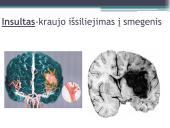 Kraujotakos sutrikimų konspektas 9 puslapis