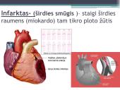 Kraujotakos sutrikimų konspektas 10 puslapis