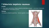 Laiptinis raumuo: priekinis vidurinis, užpakalinis (scalenius) 4 puslapis