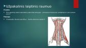 Laiptinis raumuo: priekinis vidurinis, užpakalinis (scalenius) 5 puslapis