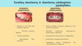 Dantų ligos 10 puslapis