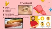 Hepatitis 8 puslapis