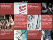 Transplantacija, ar reikėtų legalizuoti prekybą organais? 17 puslapis