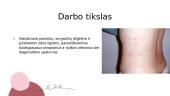 Dilgėlinė ir jos diferencinė diagnostika su pūslinėmis odos ligomis 2 puslapis