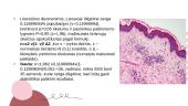 Dilgėlinė ir jos diferencinė diagnostika su pūslinėmis odos ligomis 5 puslapis