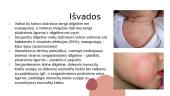 Dilgėlinė ir jos diferencinė diagnostika su pūslinėmis odos ligomis 8 puslapis