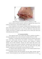 Kineziterapijos ir grįžtamojo ryšio poveikis fantominiams skausmams ir šlaunies raumenų jėgai po šlaunies amputacijos  13 puslapis