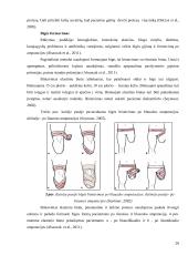 Kineziterapijos ir grįžtamojo ryšio poveikis fantominiams skausmams ir šlaunies raumenų jėgai po šlaunies amputacijos  19 puslapis