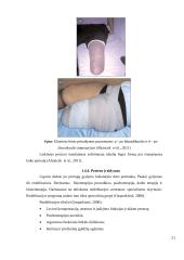 Kineziterapijos ir grįžtamojo ryšio poveikis fantominiams skausmams ir šlaunies raumenų jėgai po šlaunies amputacijos  20 puslapis