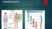 Parezė ir paraplegija: rūšys, priežastys, įvertinimas  9 puslapis