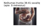Nėštumas ir gimdymas - skaidrės 2 puslapis