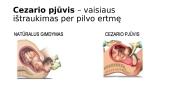 Nėštumas ir gimdymas - skaidrės 7 puslapis