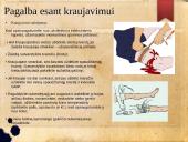 Pirmoji medicininė pagalba (skaidrės) 11 puslapis