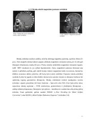 Artefaktai, jų rūšys, įtaka vaizdo formavimui ir diagnostikai 14 puslapis