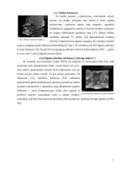 Artefaktai, jų rūšys, įtaka vaizdo formavimui ir diagnostikai 16 puslapis