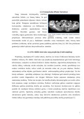 Artefaktai, jų rūšys, įtaka vaizdo formavimui ir diagnostikai 5 puslapis