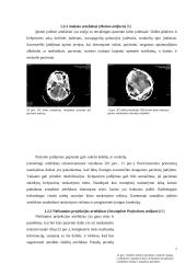 Artefaktai, jų rūšys, įtaka vaizdo formavimui ir diagnostikai 7 puslapis