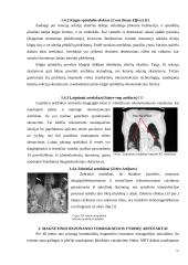 Artefaktai, jų rūšys, įtaka vaizdo formavimui ir diagnostikai 9 puslapis