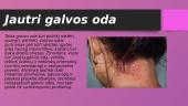 Galvos odos tipai ir jų priežiūra 3 puslapis