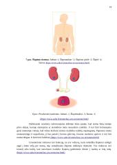 Mitybos ypatumai po stomos operacijos 13 puslapis