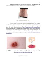 Mitybos ypatumai po stomos operacijos 4 puslapis