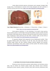 Mitybos ypatumai po stomos operacijos 5 puslapis