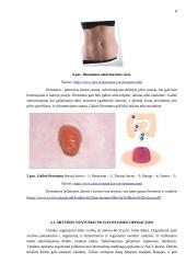 Mitybos ypatumai po stomos operacijos 7 puslapis