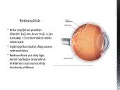 Sėkmės atvejis – Erik Weihenmayer 2 puslapis