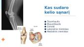 Kelio sąnarys 2 puslapis
