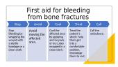 Bleeding (first aid) 13 puslapis