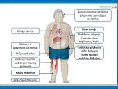 Kaip atsikratyti antsvorio?  18 puslapis