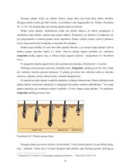 Kriminalistinis žmogaus plaukų tyrimas: galimybės ir praktika Lietuvoje  17 puslapis