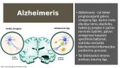Alzheimerio ligos paveldimos ir nepaveldimos formos 2 puslapis