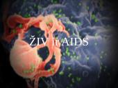 ŽIV ir AIDS (skaidrės)