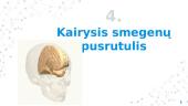 Smegenų funkcijos 11 puslapis