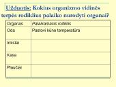 Homeostazė ir termoreguliacija (skaidrės) 16 puslapis