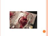 Kraujo donorystė (skaidrės) 18 puslapis