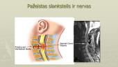 Periferinė nervų sistema, nugaros smegenys 18 puslapis