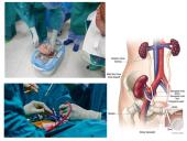 Dializė, donorystė 12 puslapis