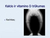 Vitaminai ir mineraliniai elementai (skaidrės) 11 puslapis