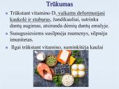 Vitaminai ir mineraliniai elementai (skaidrės) 7 puslapis