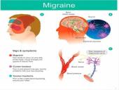 Migraine 2 puslapis