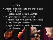 Abortion: is abortion the right choice? 3 puslapis