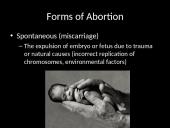 Abortion: is abortion the right choice? 5 puslapis