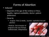 Abortion: is abortion the right choice? 6 puslapis