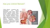 Cistinė fibrozė 2 puslapis